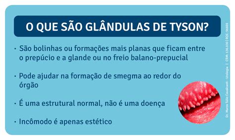 Glândulas de Tyson: o que são, porque aparecem e。